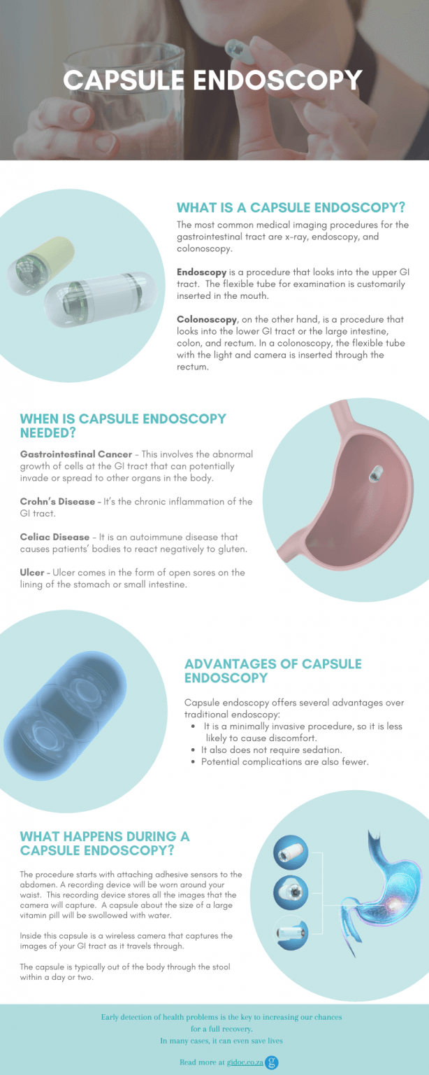 Capsule Endoscopy What Is It and How Does It Work?