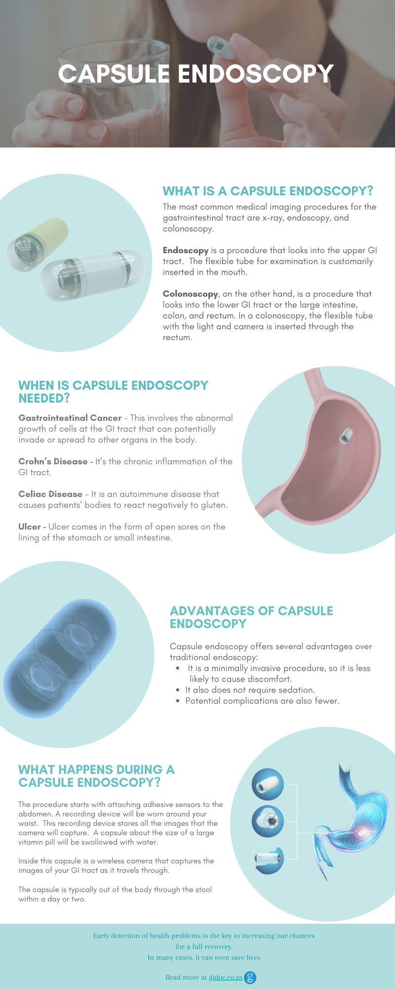 capsule-endoscopy-infographic