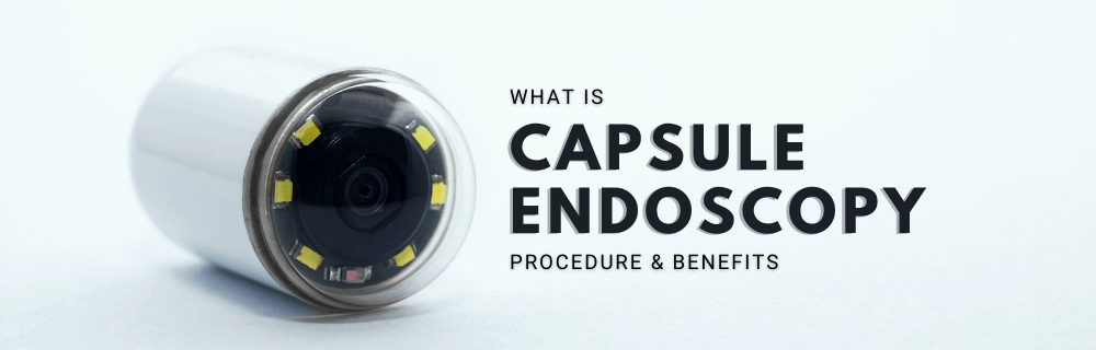 What Is A Capsule Endoscopy Procedure And Benefits Gidoc Cpt