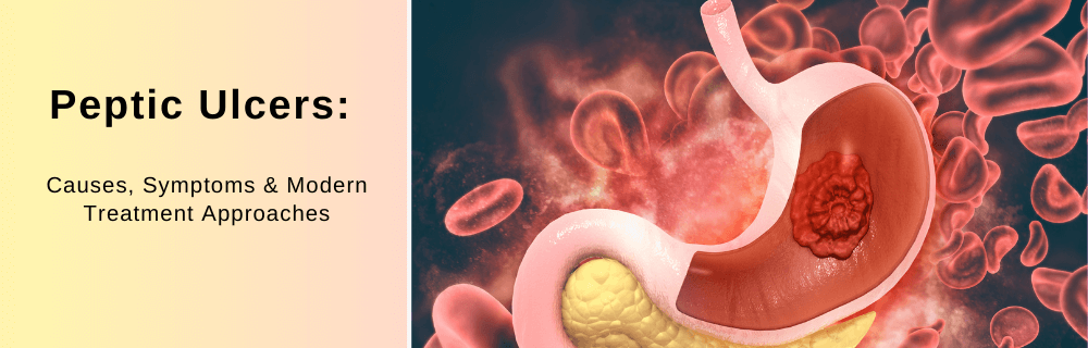 Peptic Ulcers: Causes, Symptoms, and Modern Treatment Approaches