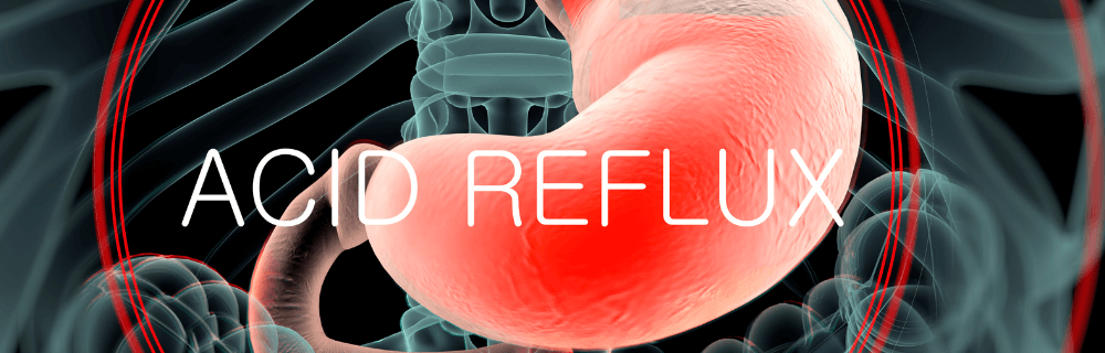 Managing Acid Reflux: Causes, Symptoms, and Treatment Strategies