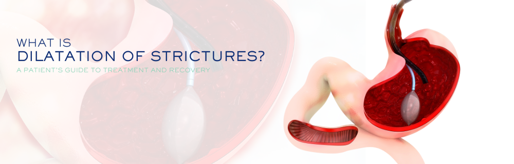 What Is Dilatation of Strictures? A Patient’s Guide to Treatment and Recovery