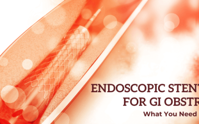Endoscopic Stent Placement for GI Obstruction: What You Need to Know