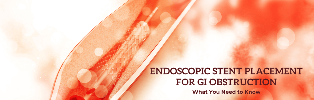 endoscopic_stent_placement_main