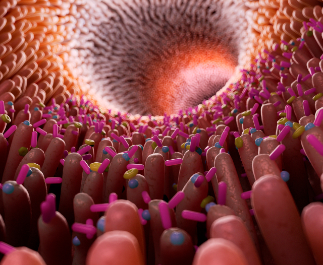 gi_strictures_and_dilation