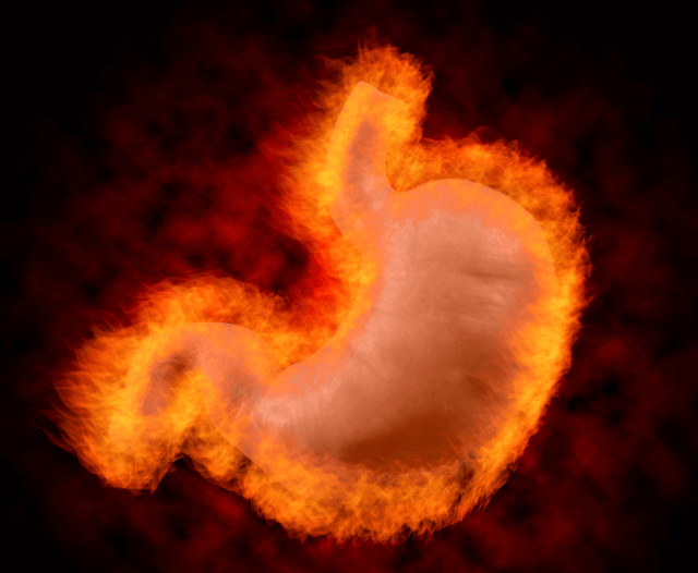 gerd_symptoms