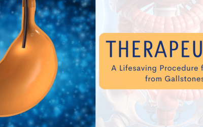 Therapeutic ERCP: A Lifesaving Procedure for Biliary Obstruction from Gallstones and Cancer