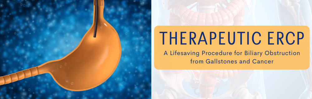 Therapeutic ERCP: A Lifesaving Procedure for Biliary Obstruction from Gallstones and Cancer