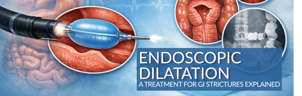 endoscopic_dilation_main