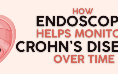 How Endoscopy Helps Monitor Crohn’s Disease Over Time