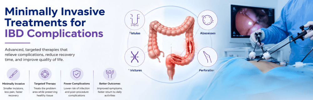 Minimally Invasive Treatments for IBD Complications