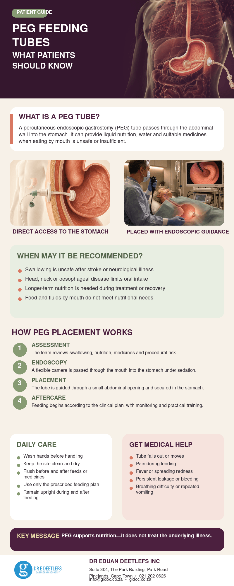 peg_feeding_tubes_infographic