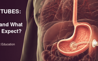 PEG Feeding Tubes: When Are They Needed?